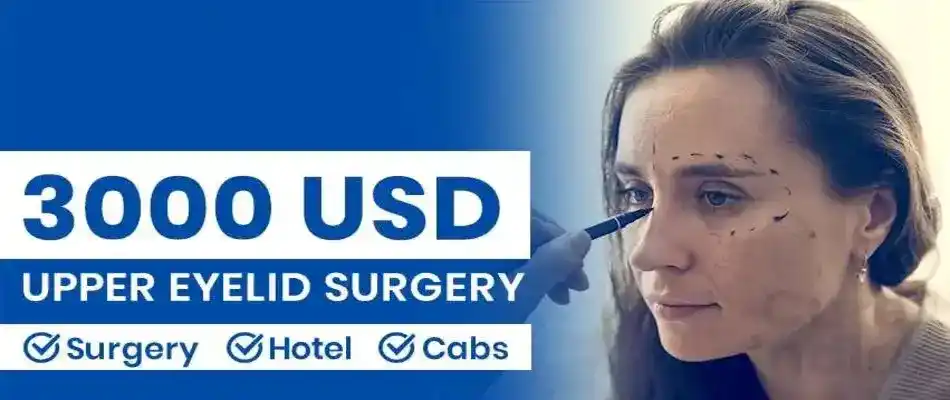 Upper Eyelid Surgery Cost